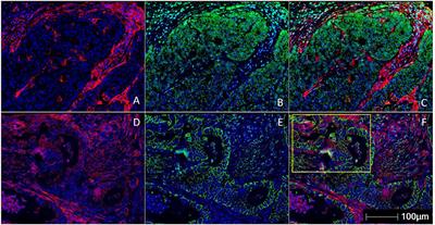 Predictive Biomarkers of Immune Checkpoint Inhibition in Gastroesophageal Cancers